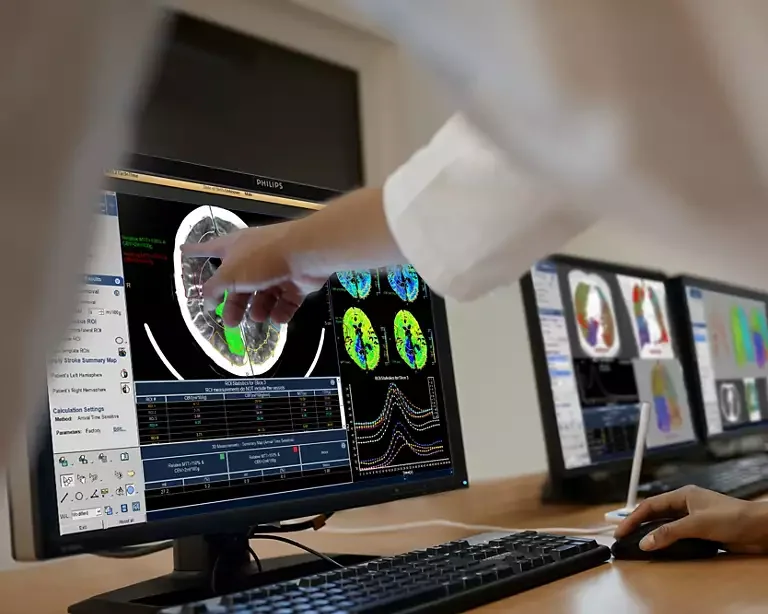 Optimization services